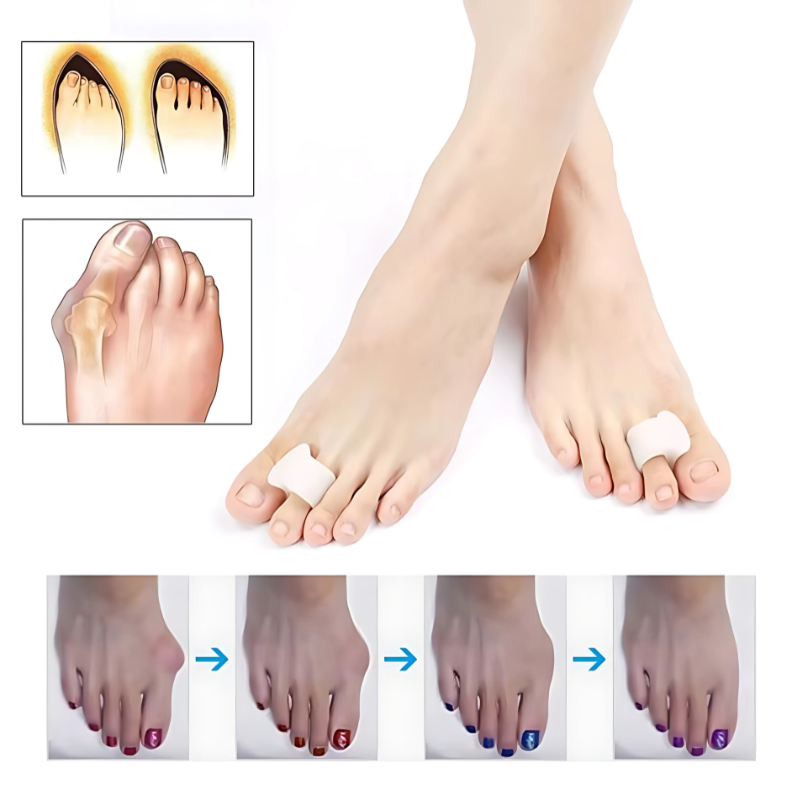 CORRECTOR DE JUANETE FÉRULA ALIVIO TOTAL