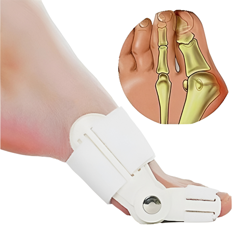 BENEFICIOS DE USAR CORRECTOR DE JUANETE